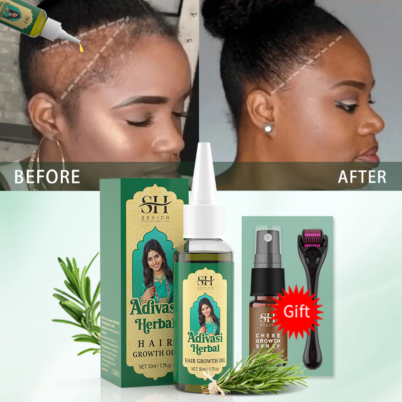 Ayurvedic Hair Growth Oil Indi - Hair Care Indian avis et prix