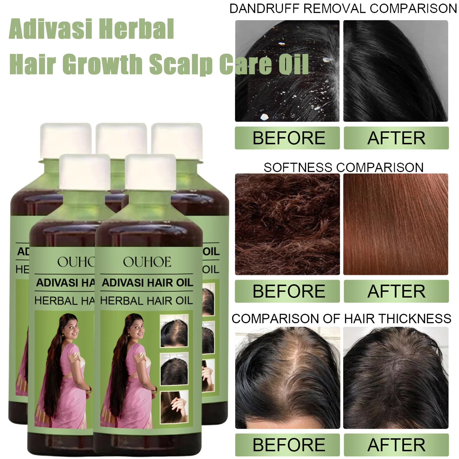 100ml Hair Growth Oil India Ad - Hair Care Indian avis et prix