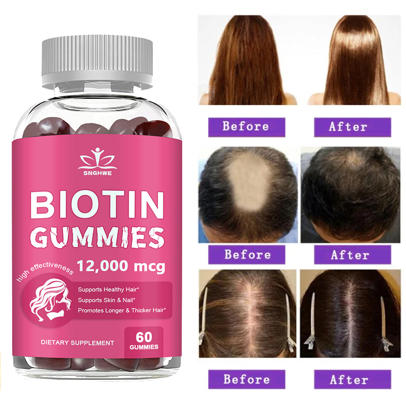 Collagen Gummies Biotin Gummie - Hair Care Gummies avis et prix