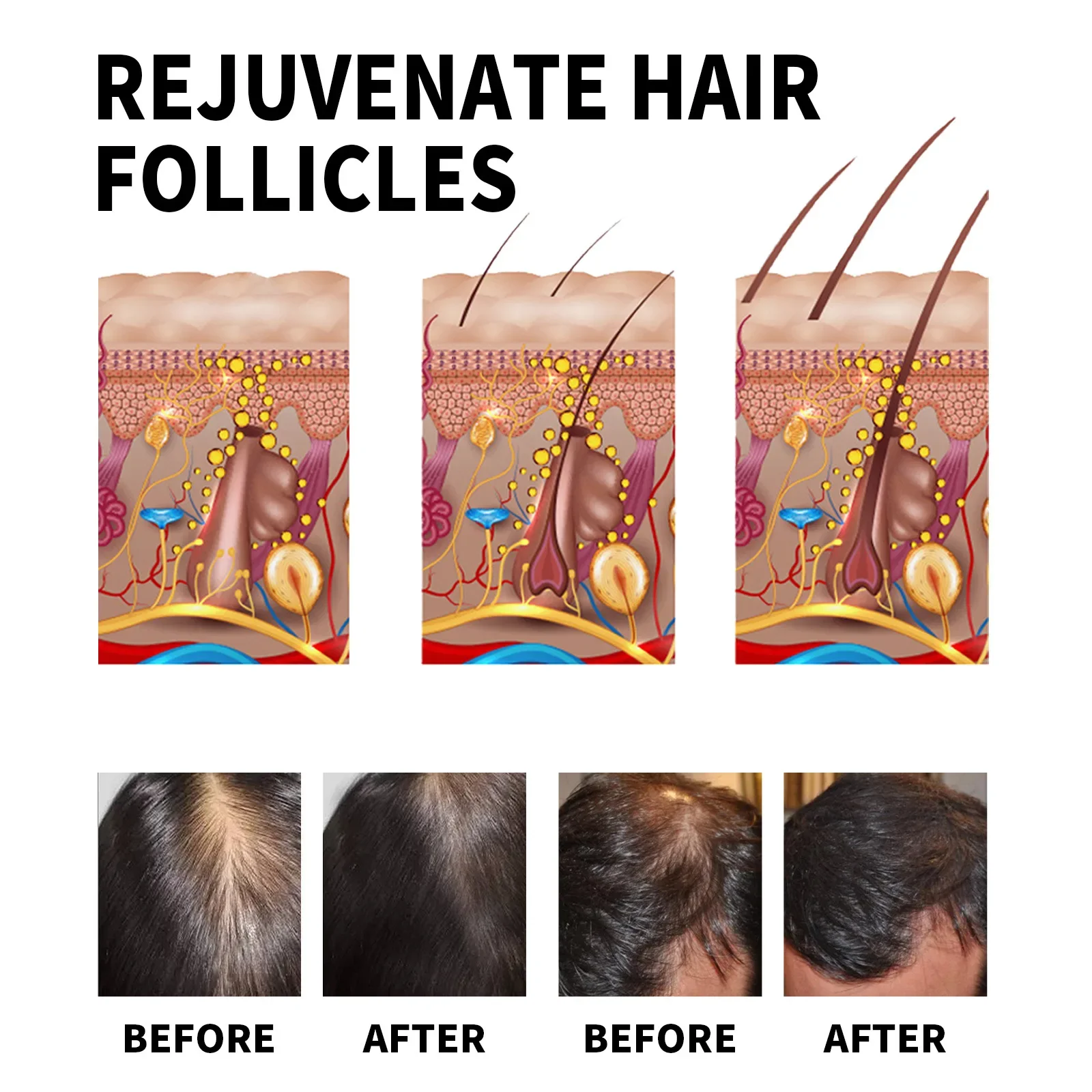 Ginger Hair Growth Products Fa - Hair Care For Dry And Frizzy Hair avis et prix