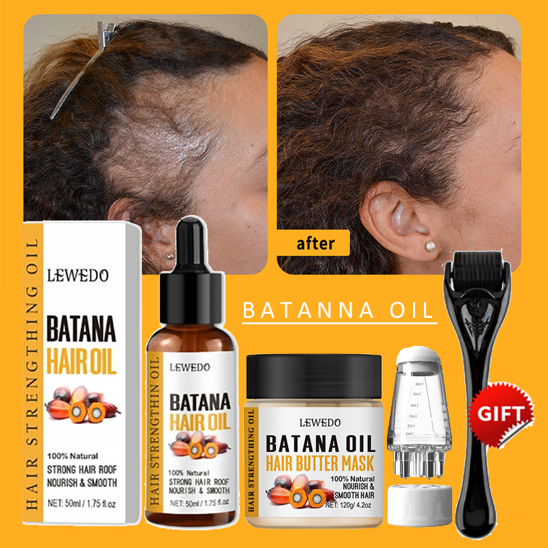 Batana Oil Hair Growth Kit Tra - Keratin Treatment Set avis et prix